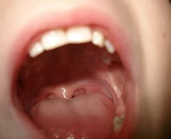 アイコスが熱いって人